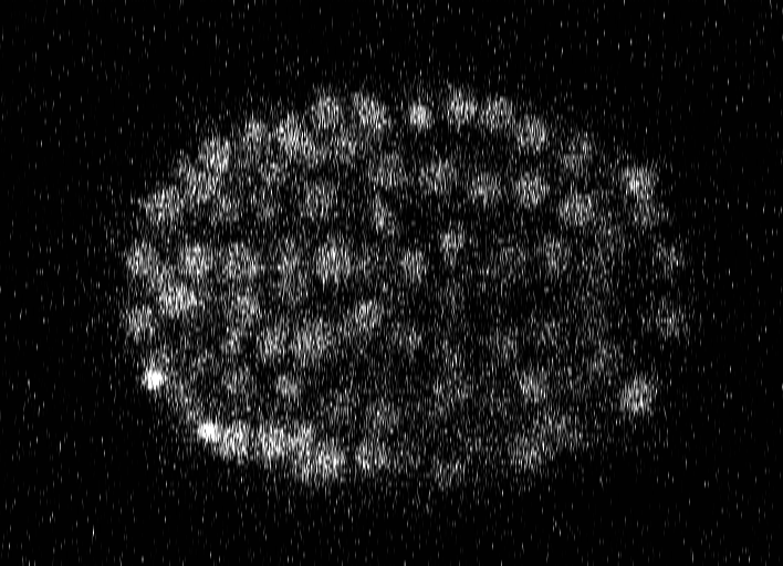 C. elegans embryo raw slice